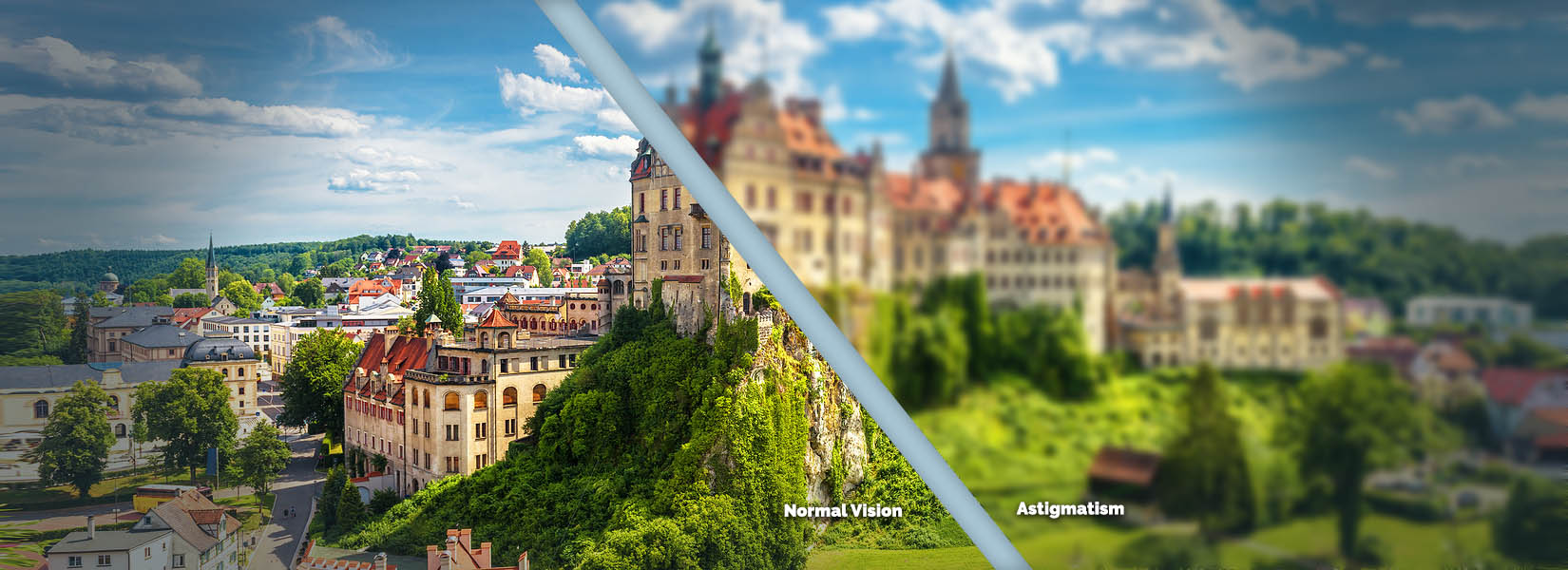 Astigmatism Treatment in Inner West Side