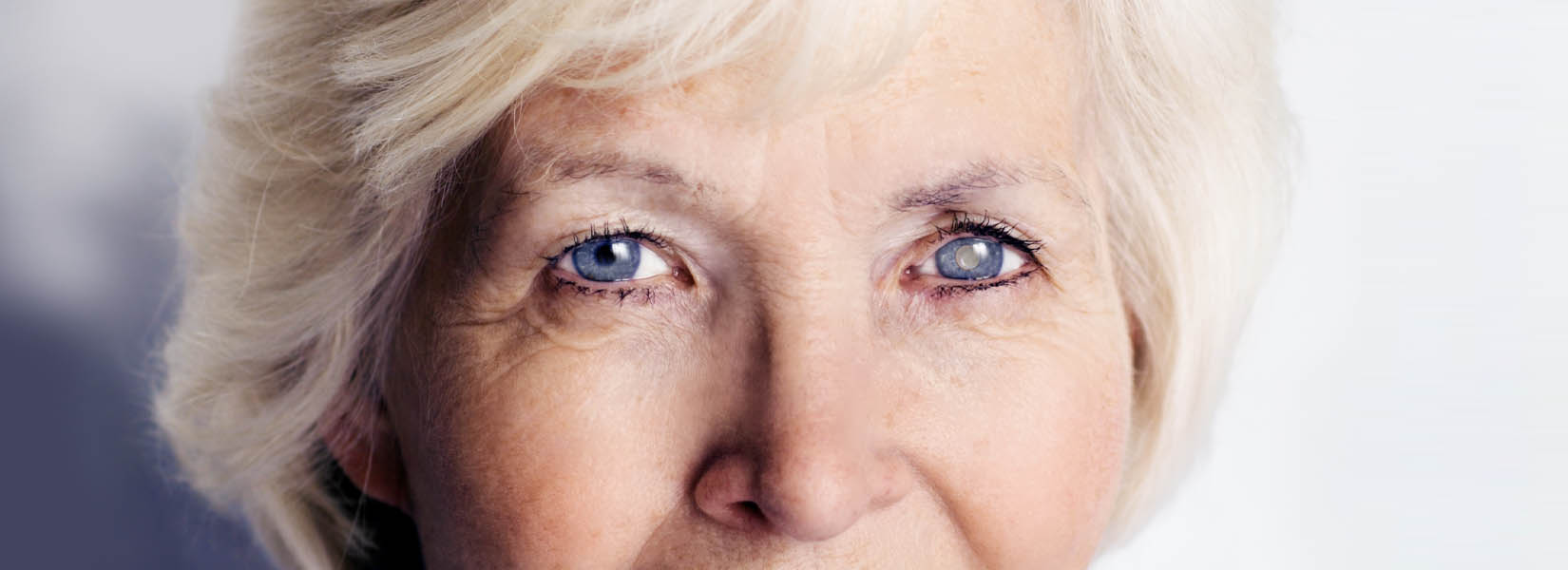 Cataract Surgery in Inner West Side
